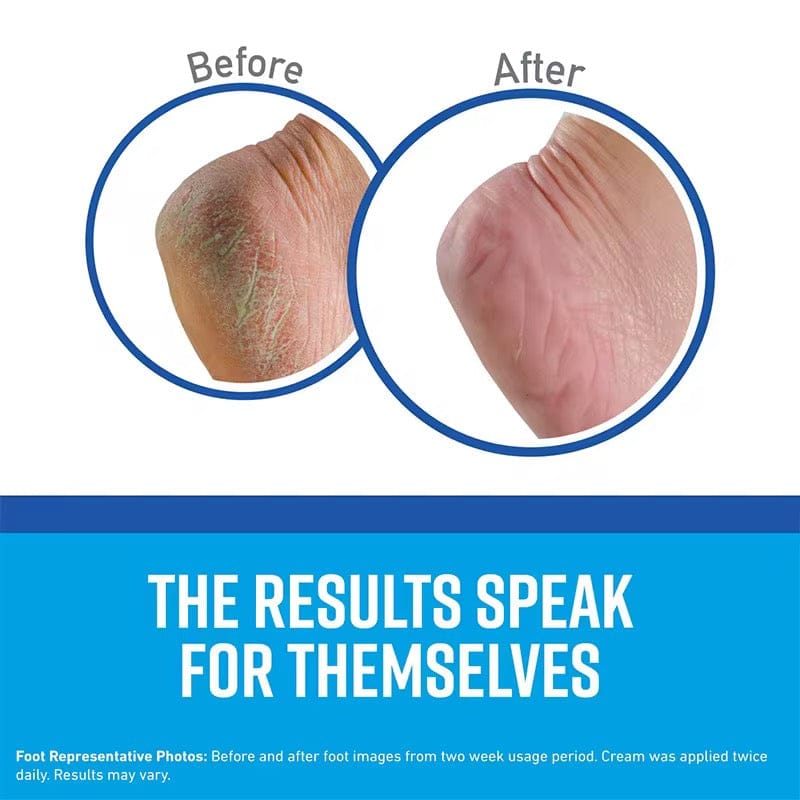 Healthy Feet Cream